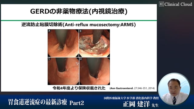 胃食道逆流症の最新診療 Part2