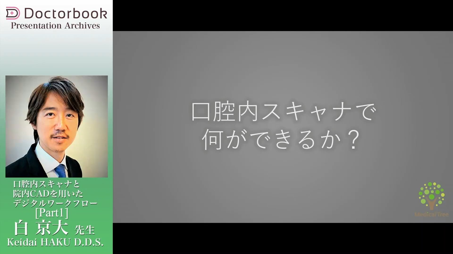 臨床知見録_光学印象_口腔内スキャナとは