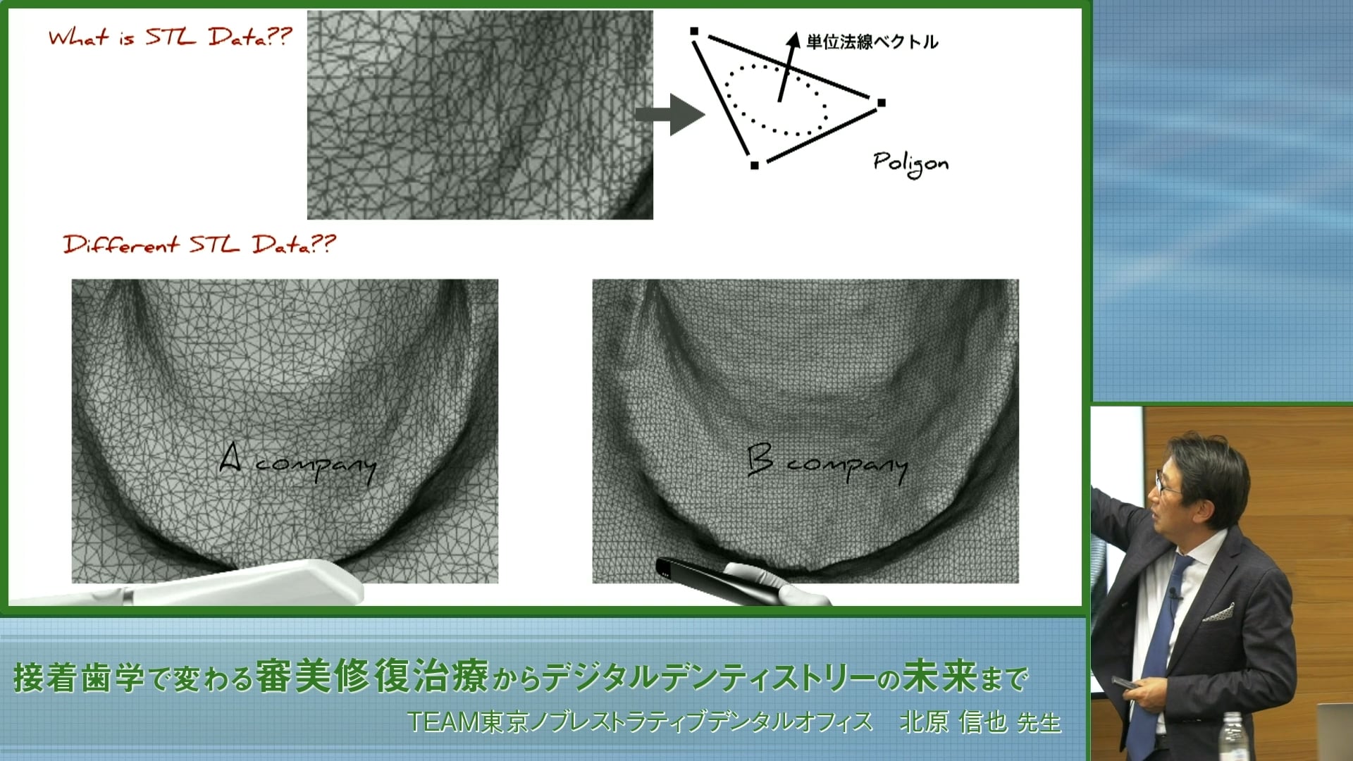 臨床知見録_光学印象_STLデータ