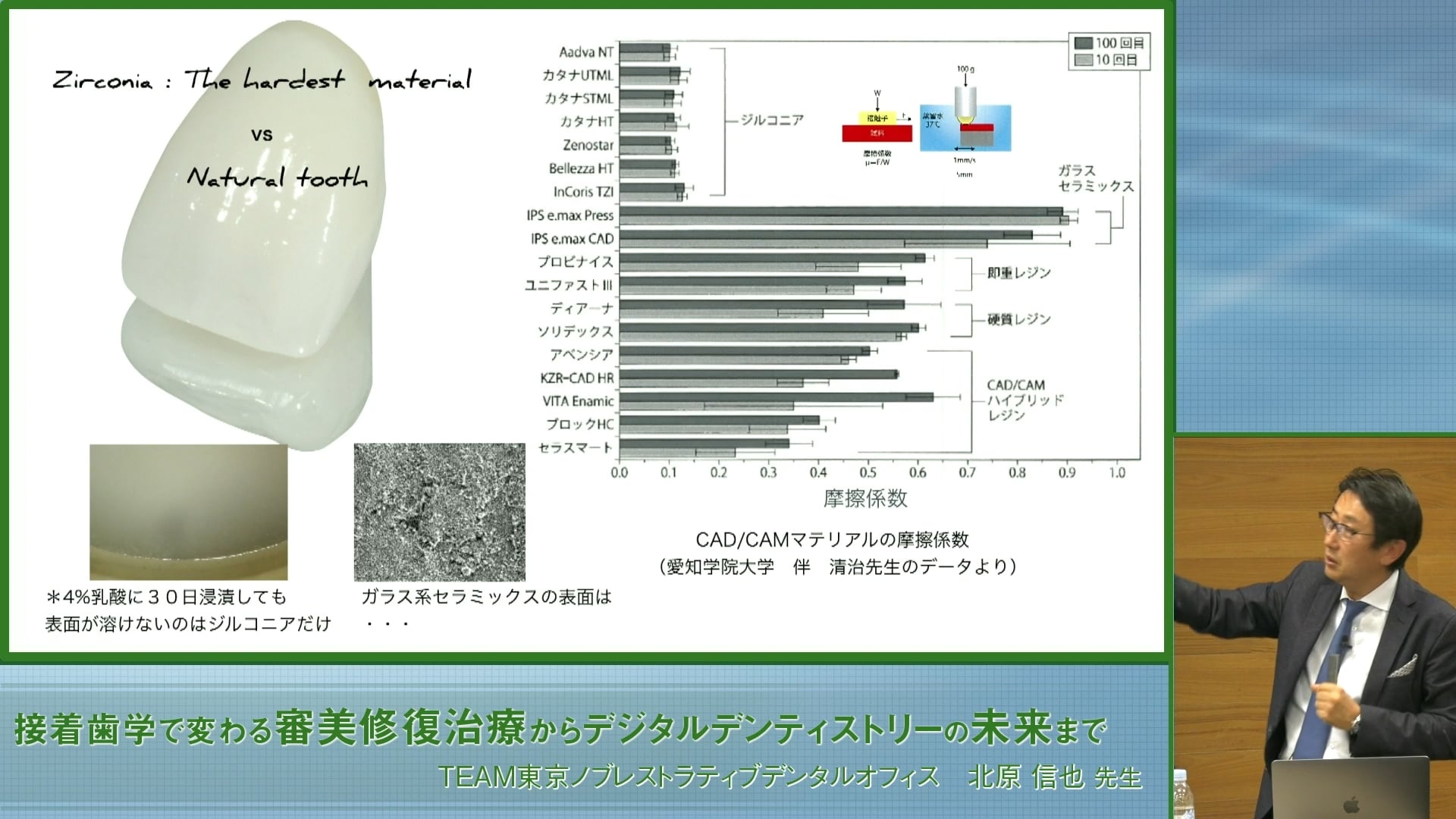 臨床知見録_光学印象_CAD/CAMでの補綴、ジルコニアについて