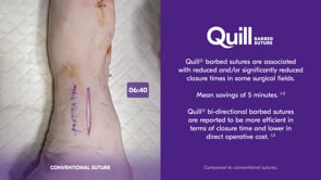 Corza Quill Suture Demonstration Video