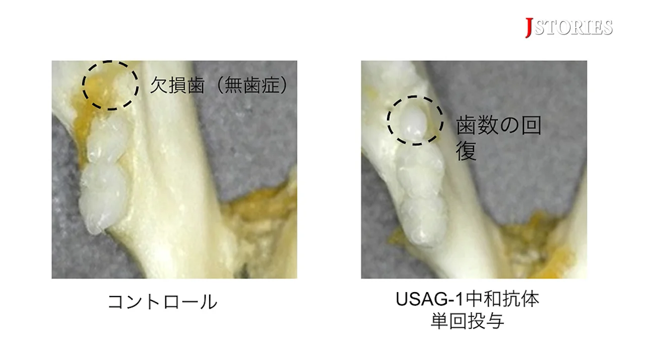 0922_toregem_JP