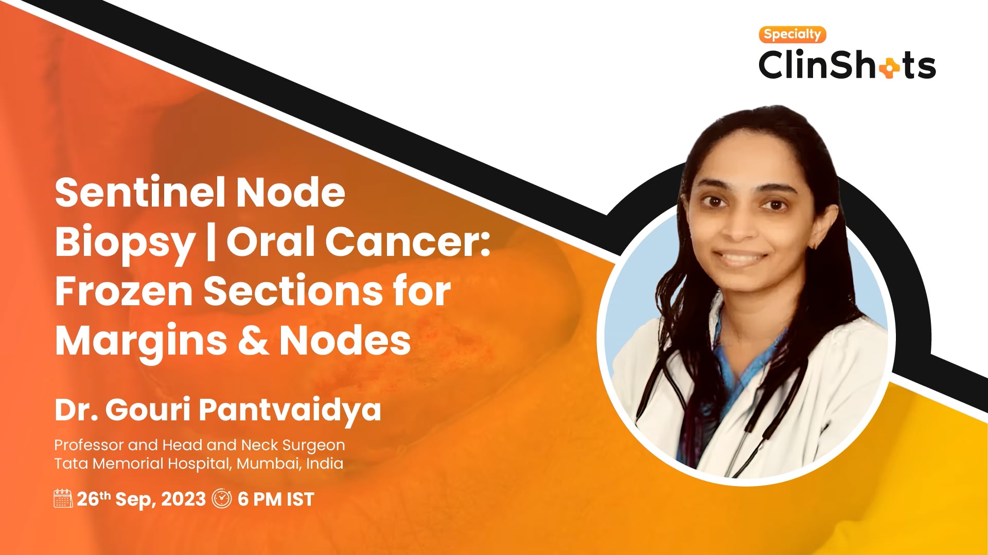 Sentinel Node Biopsy | Oral Cancer: Frozen Sections for Margins & Nodes
