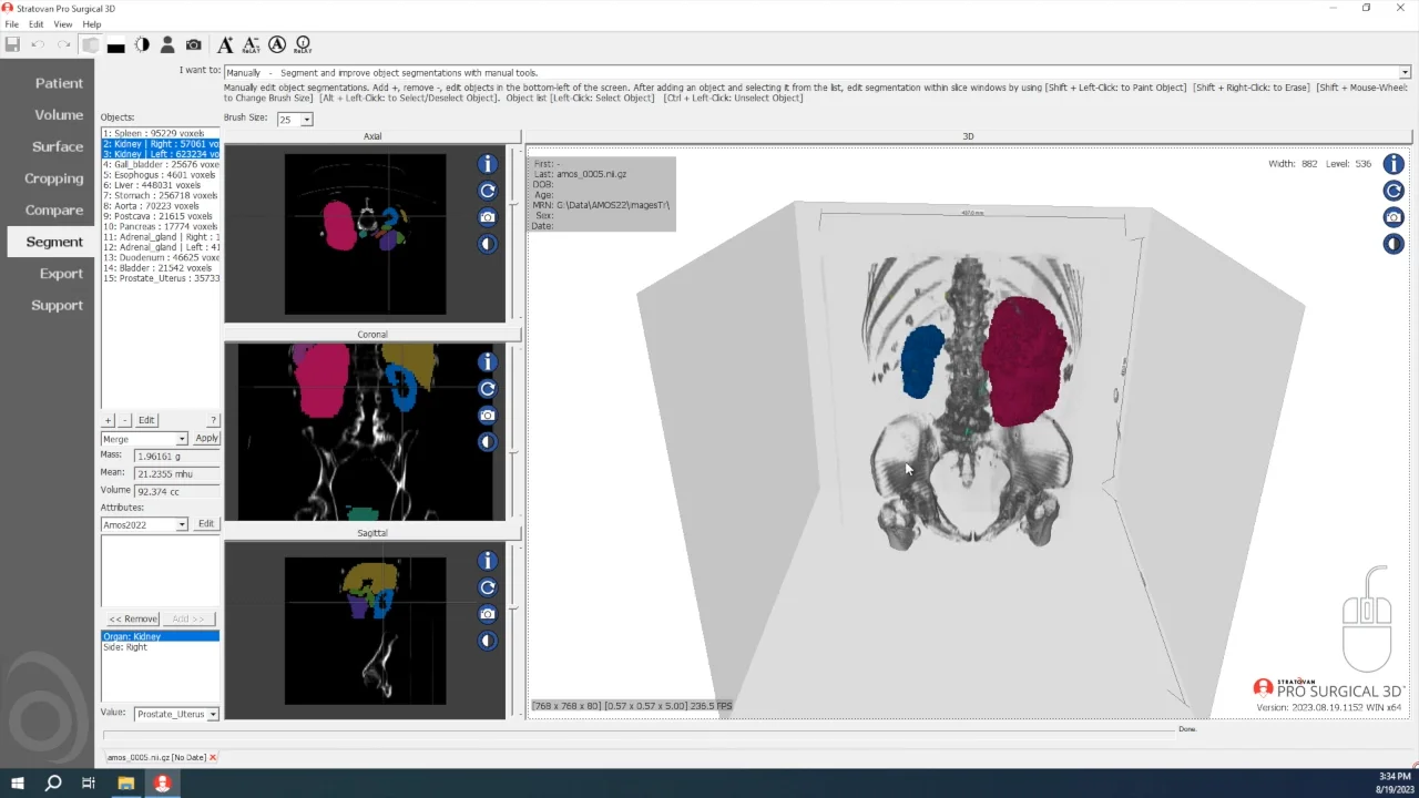 QA6 on Vimeo