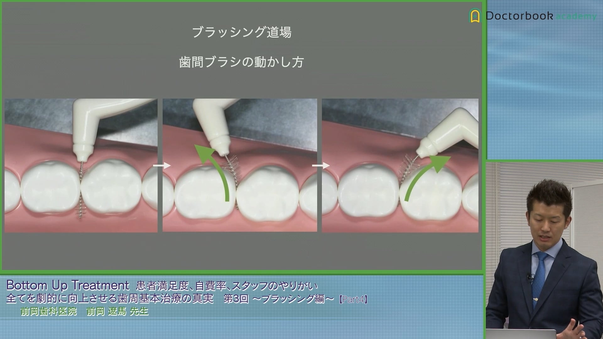 臨床知見録_プラークコントロール_歯間ブラシの動かし方