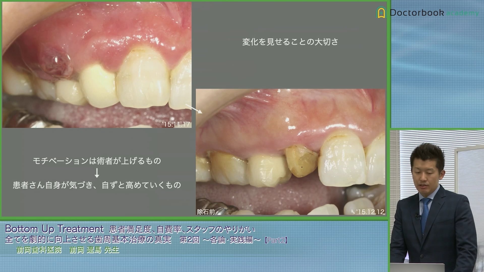 臨床知見録_プラークコントロール_変化を見せることの大切さ