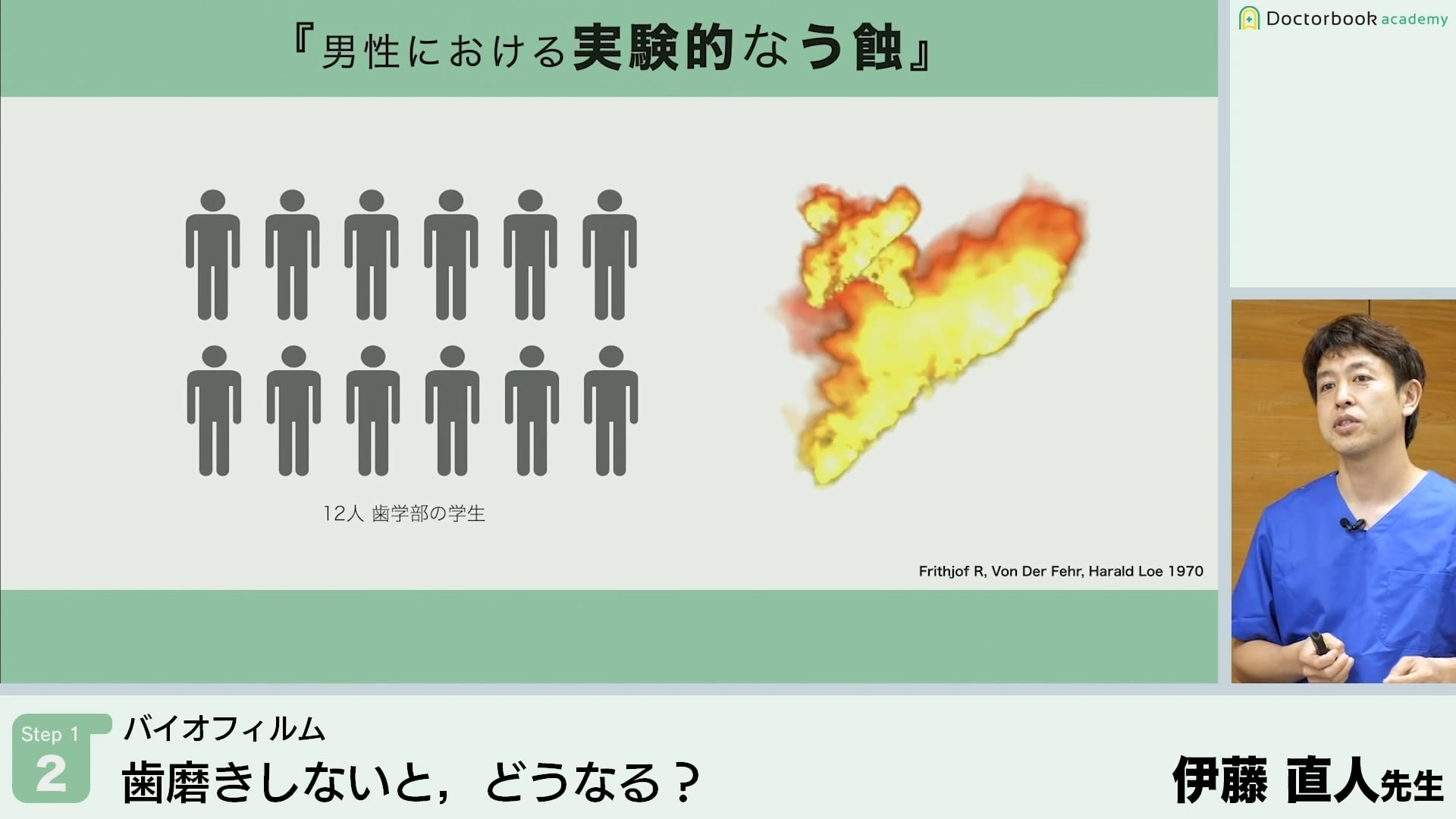 臨床知見録_プラークコントロール_ブラッシングをしないことによるカリエスの発生度合い