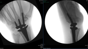 Vimeo video – thumbnail