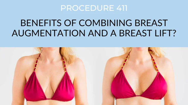 Breast Lift Benefits