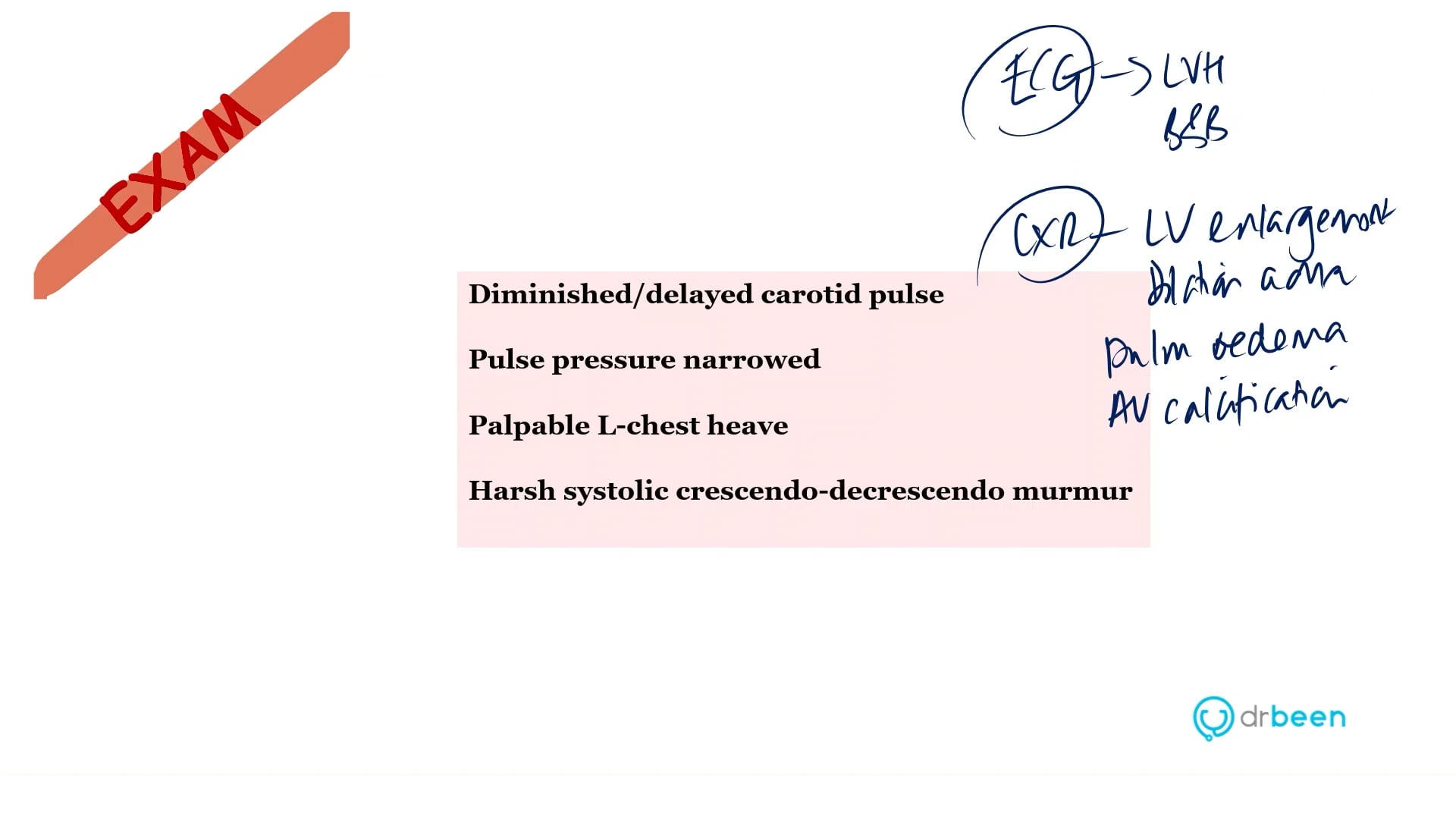 Aortic Stenosis (Dr. Bhatti)
