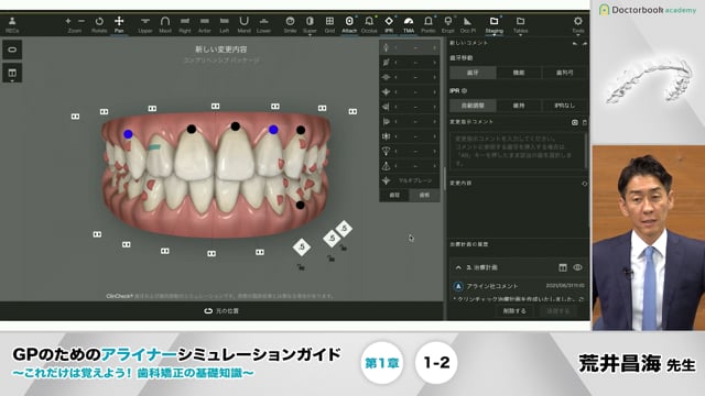 1-2 クリンチェックの基本的な使い方