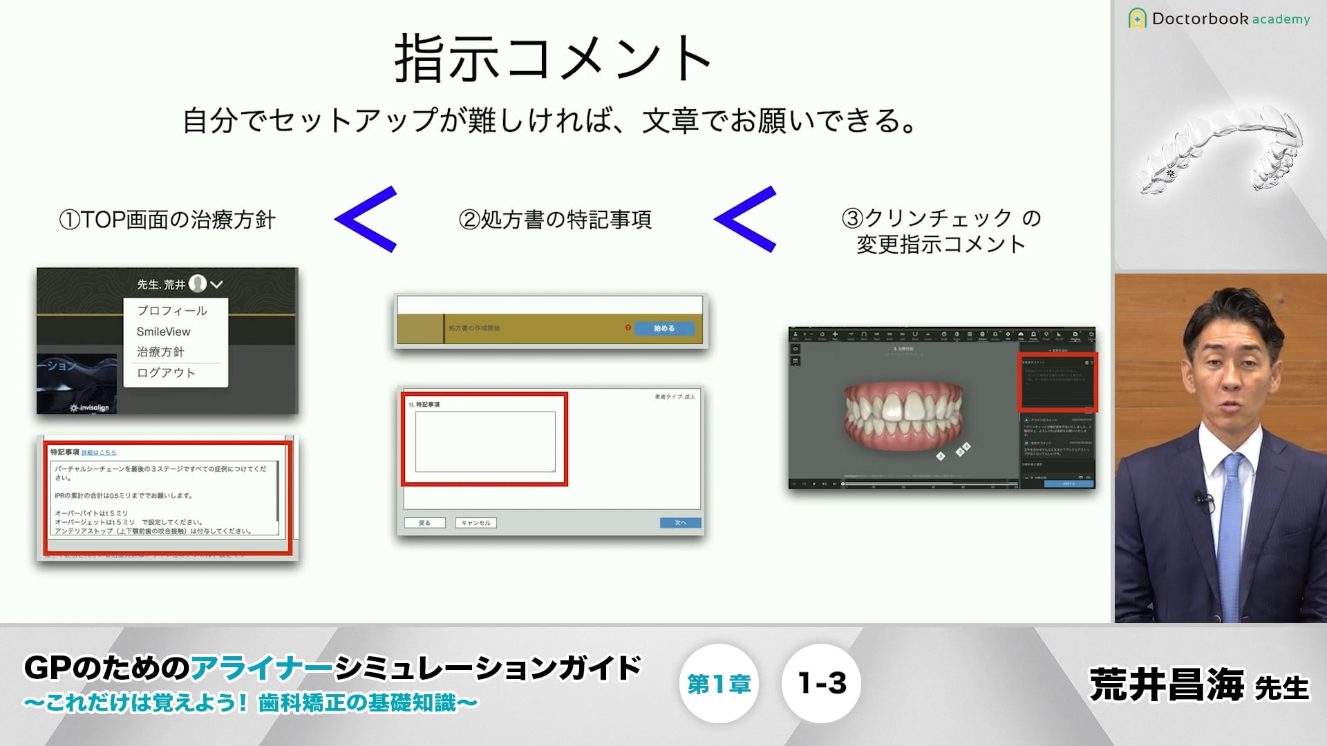 1-3 クリンチェックの文章によるセットアップ