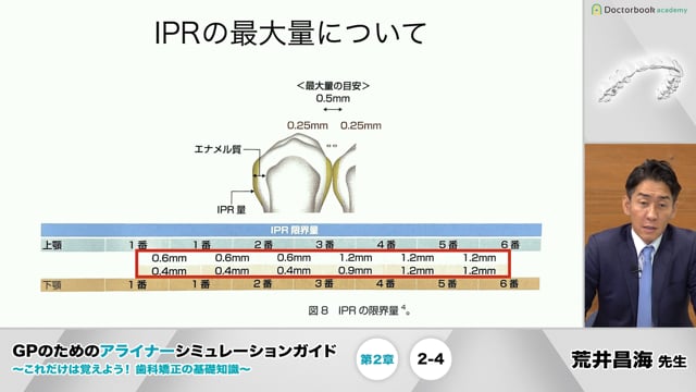 2-4 IPR(隣接面削合)