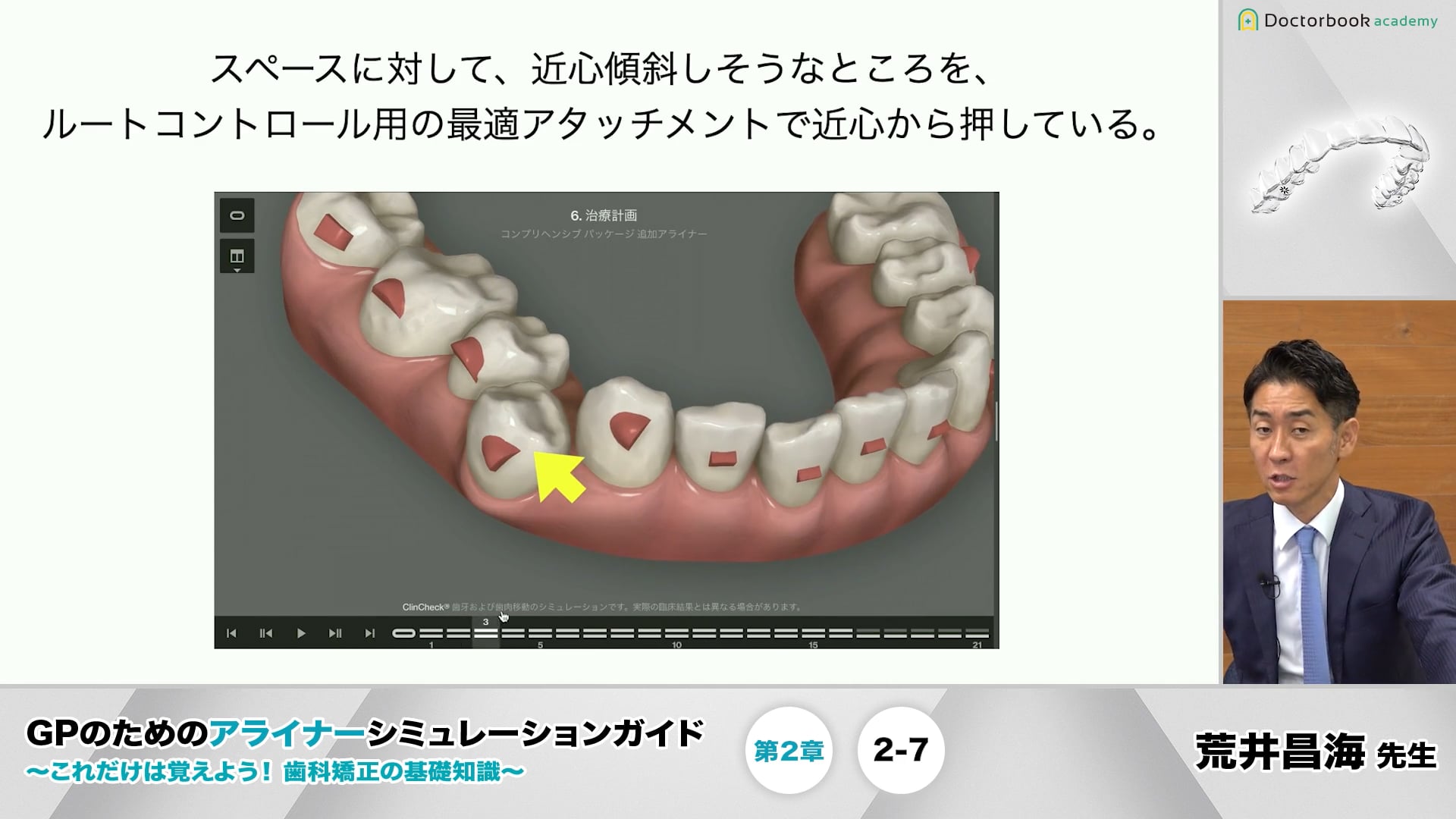 2-7 最適アタッチメント