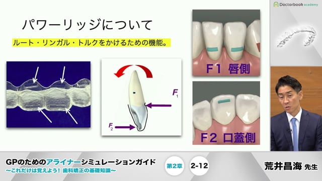 第2章 インビザラインのアライナーの特徴│GPのためのアライナー