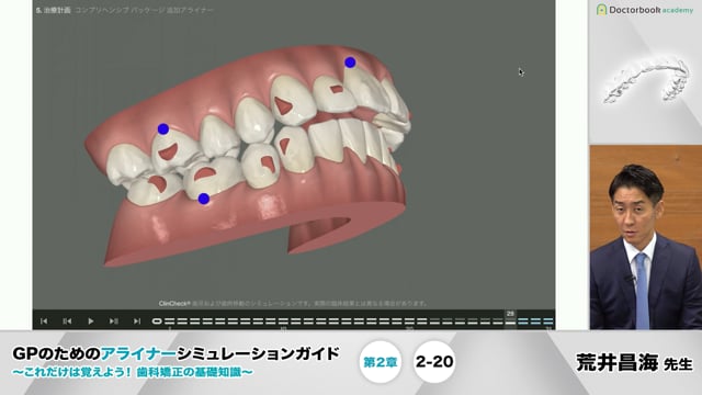 2-20 追加アライナーの処方書の書き方【02/13-02/19 プレミアム化】