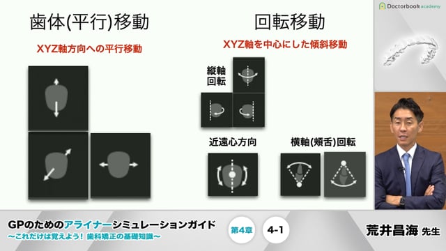 4-1 歯の動き方の種類