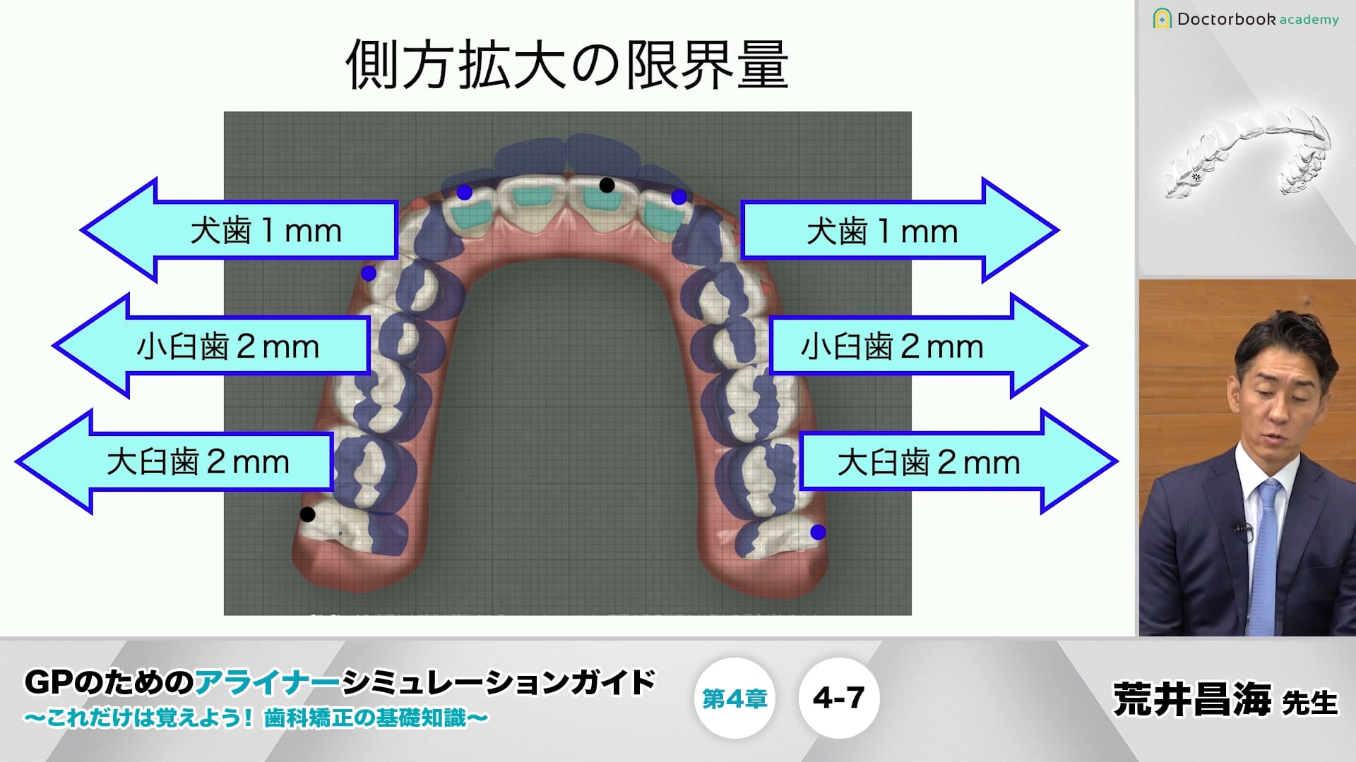 4-7 側方拡大