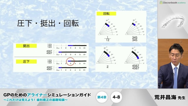 第4章 移動量と移動限界│GPのためのアライナーシミュレーションガイド 