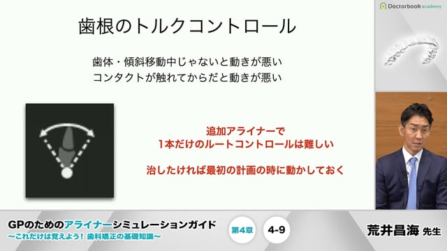 第4章 移動量と移動限界│GPのためのアライナーシミュレーションガイド 