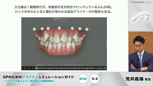 GPのためのアライナーシミュレーションガイド 〜これだけは覚えよう 