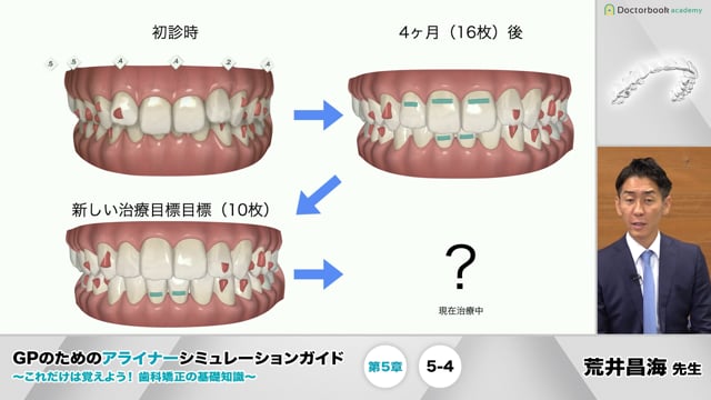 5-4 II級症例