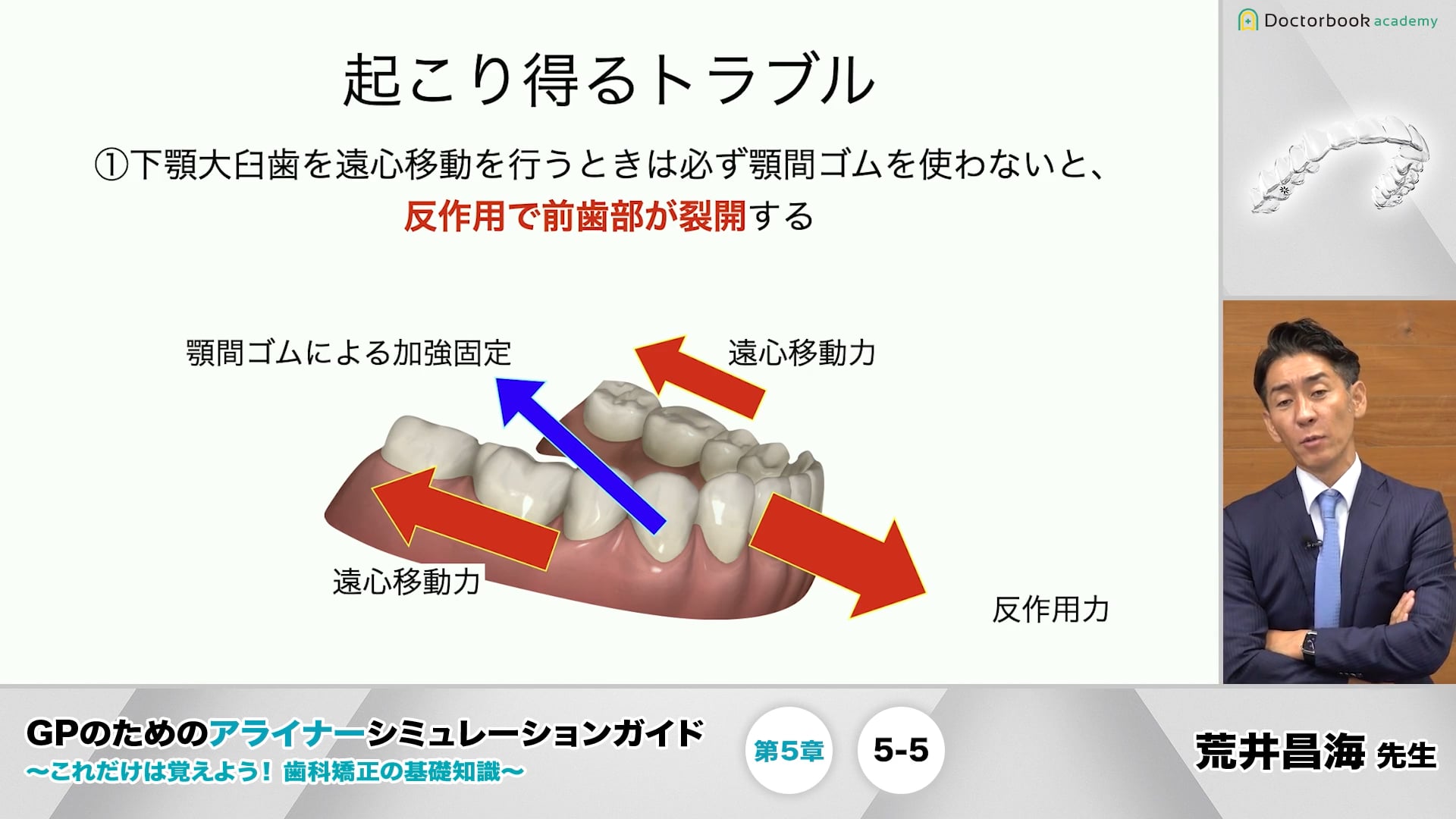 5-5 III級症例