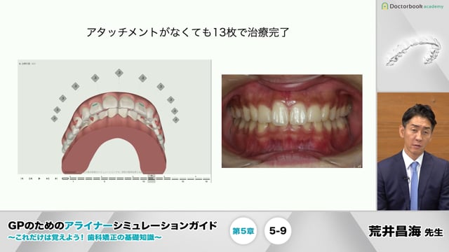 5-9 翼状捻転