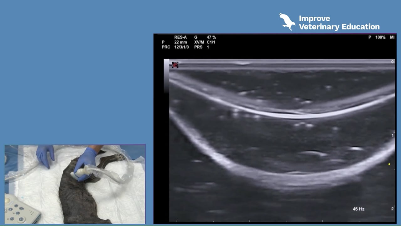Ultrasound-guided TAP block