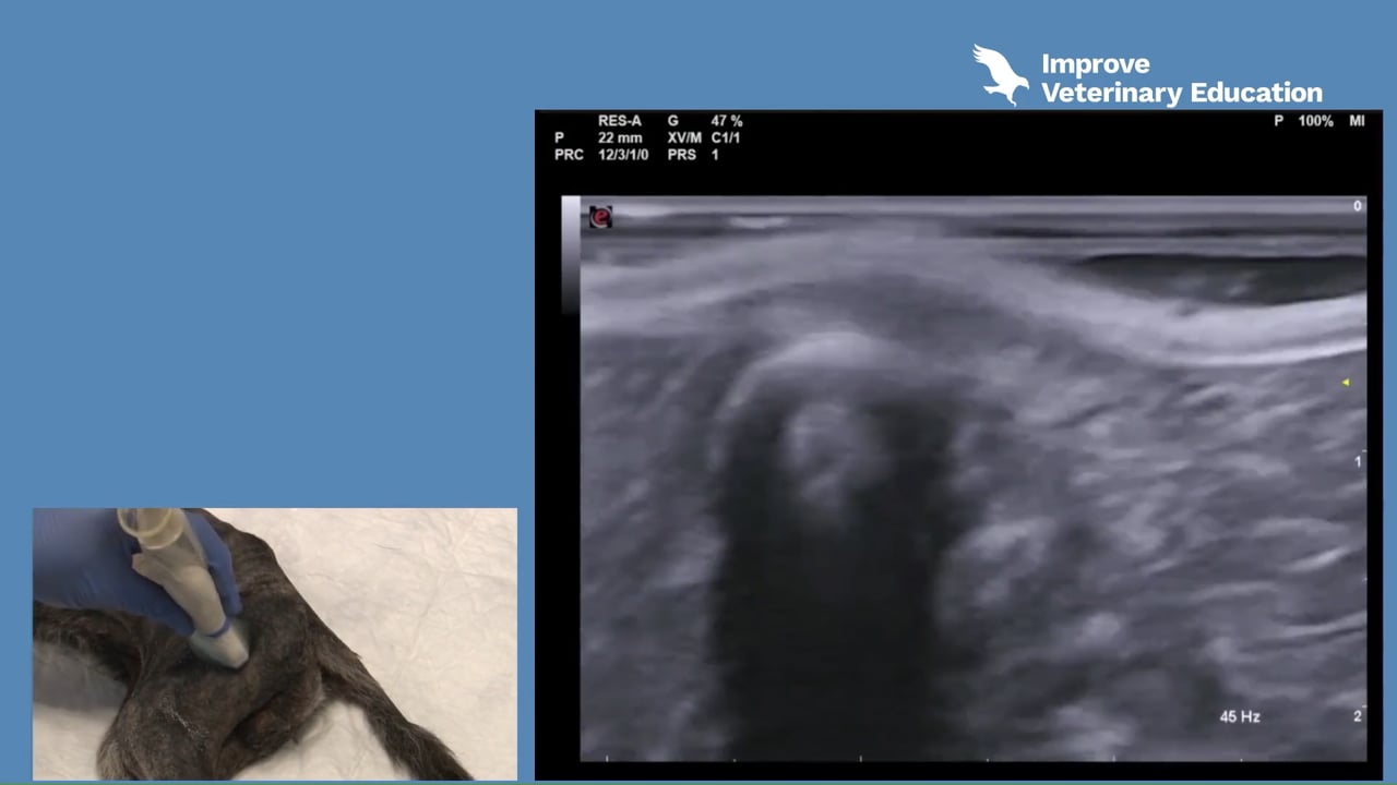 Ultrasound-guided sciatic nerve block