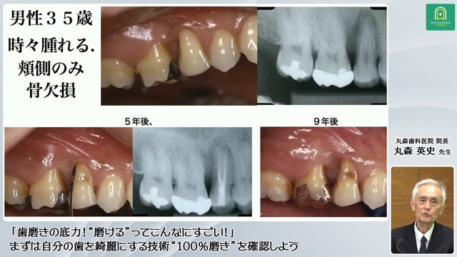 『毛先磨き』指導例の紹介│丸森 英史先生