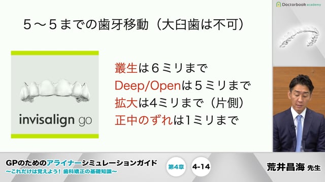 第4章 移動量と移動限界│GPのためのアライナーシミュレーションガイド 