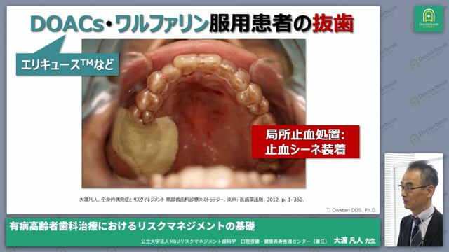 有病高齢者歯科治療におけるリスクマネジメントの基礎 | Doctorbook