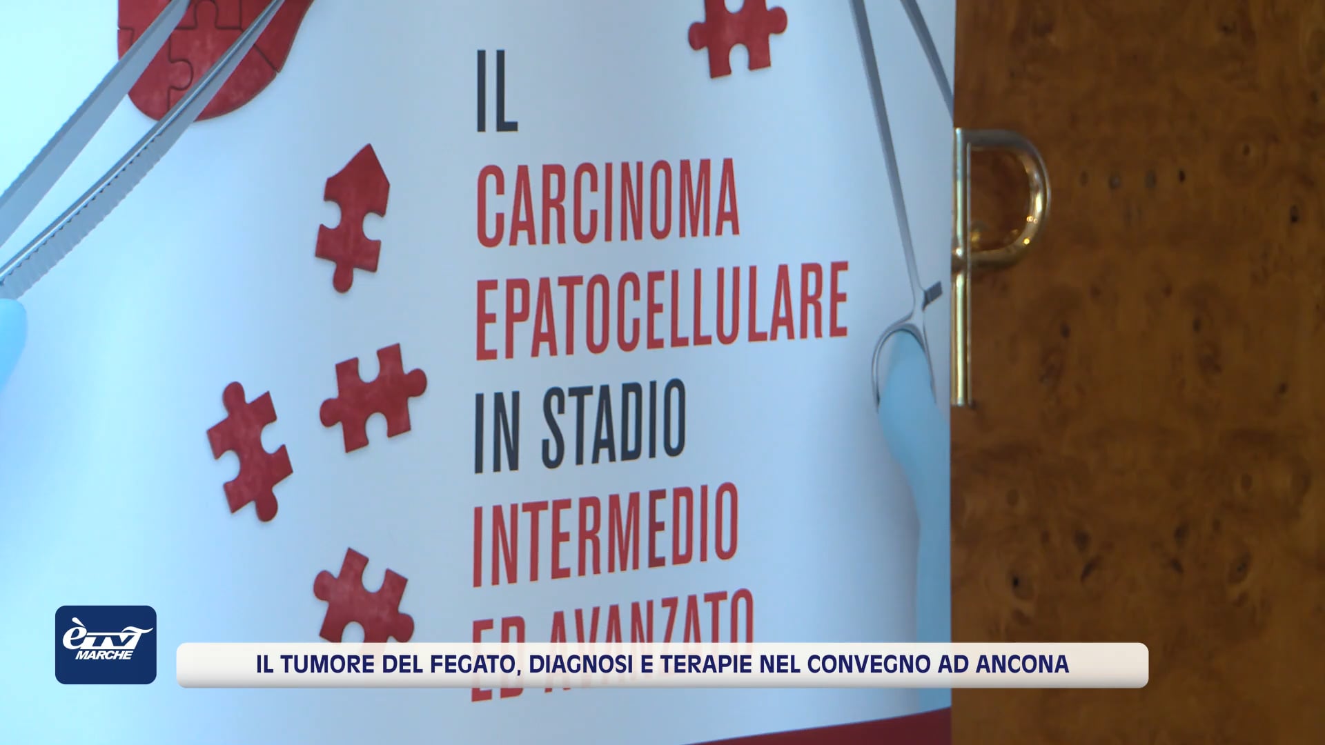 Il Tumore Del Fegato, Diagnosi E Terapie Nel Convegno Ad Ancona - VIDEO ...