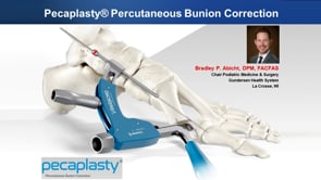 Pecaplasty® Instrumented MIS System