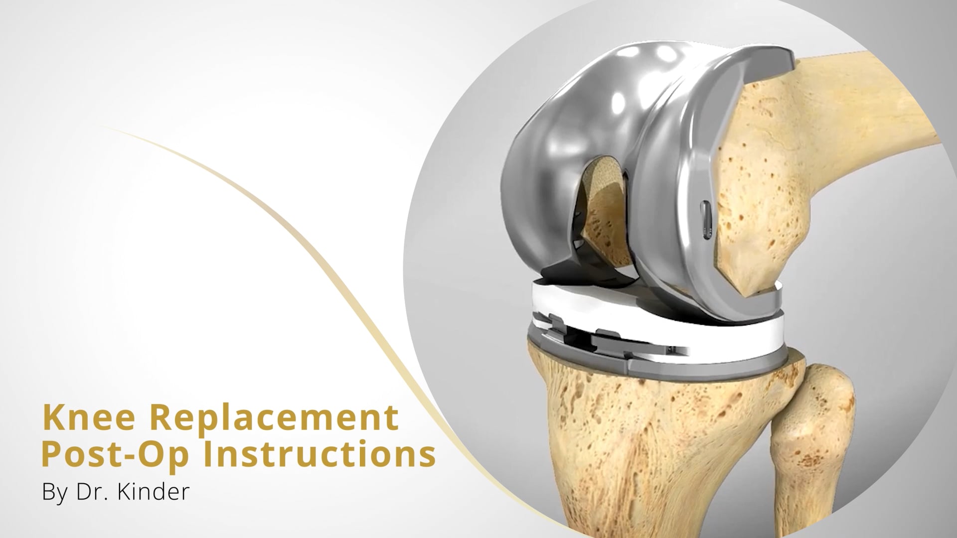 Knee Replacement Post-Op Instructions - Dr. Kinder