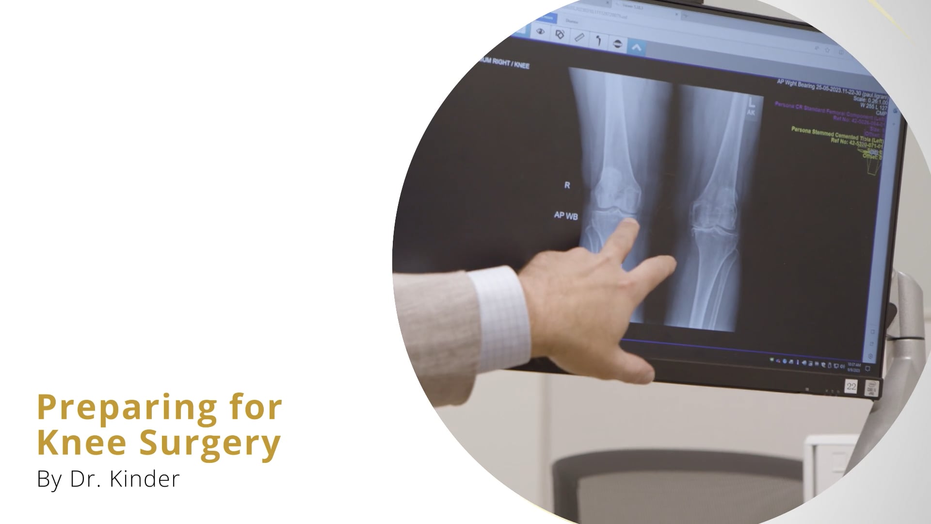 Preparing for Knee Surgery - Dr. Kinder
