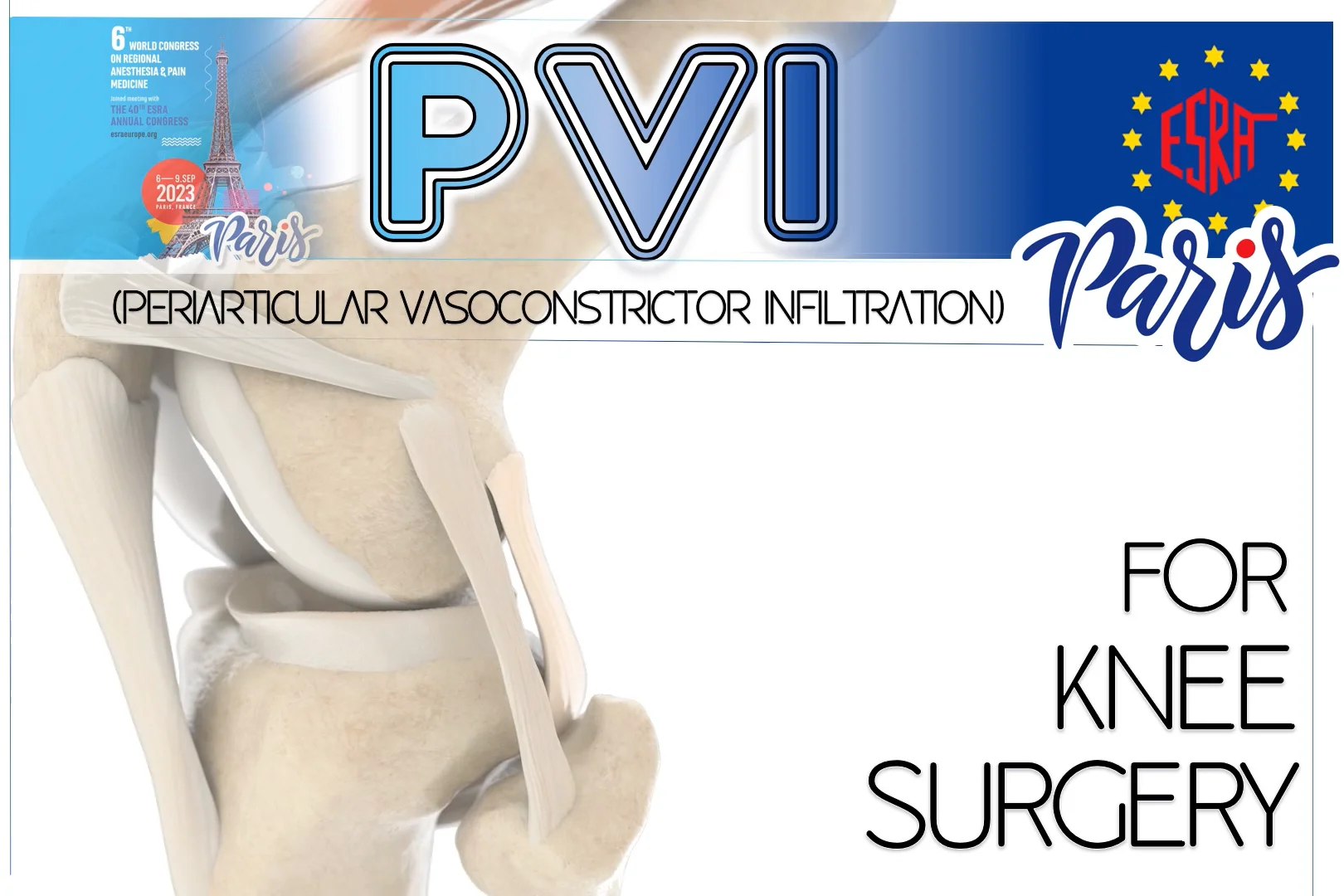 PVI (Periarticular Vasoconstrictor Infiltration) for Knee Surgery, by ...