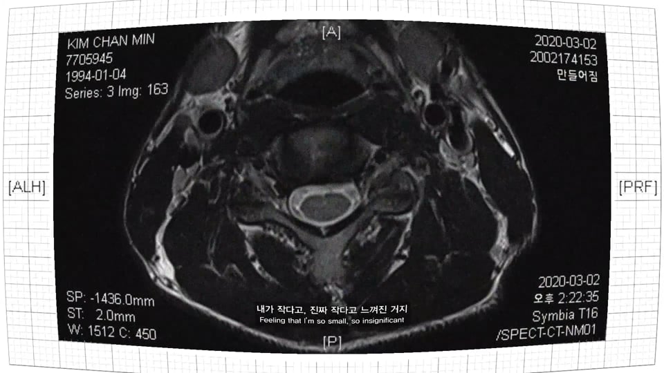 MRI fiction journey