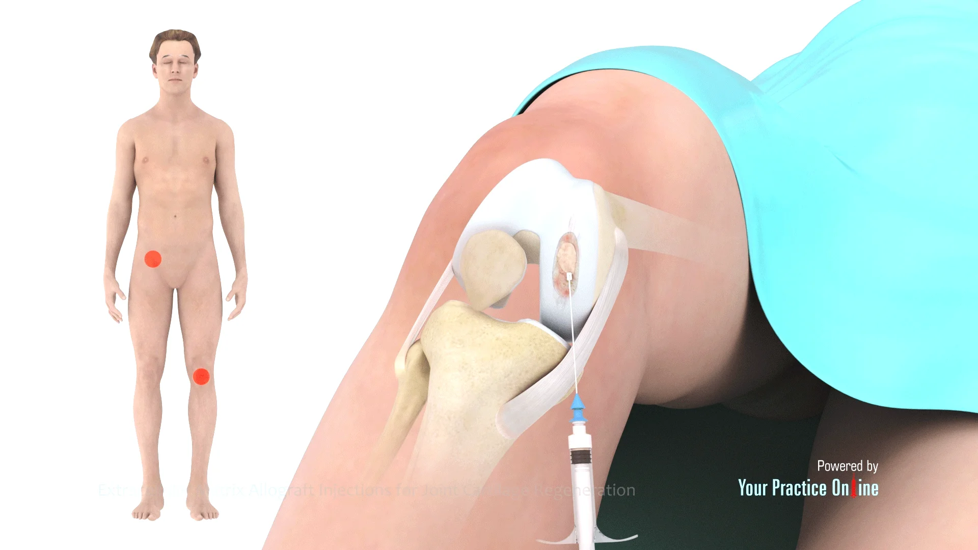 b12 and ecm injection Vitamin Sites: All You Need to Know Vitamin B12 Injection at a