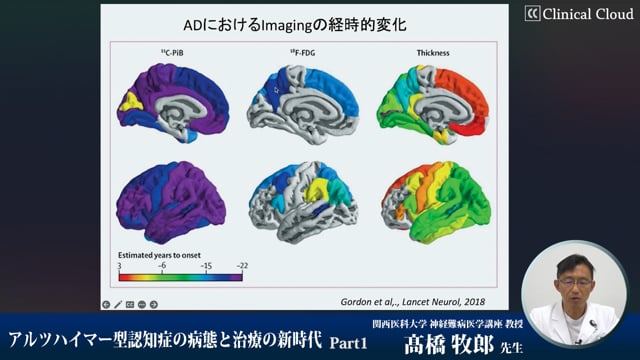 アルツハイマー型認知症の病態と治療の新時代　Part1