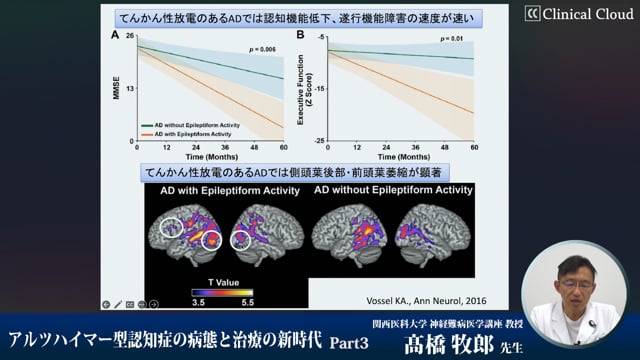 アルツハイマー型認知症の病態と治療の新時代　Part3