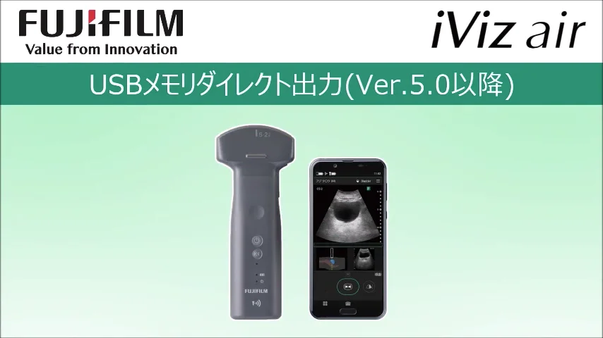 ポータブルエコー 超音波 コンベックス 保証期間中 説明書、ゼリー、カバー付属 1743352498-