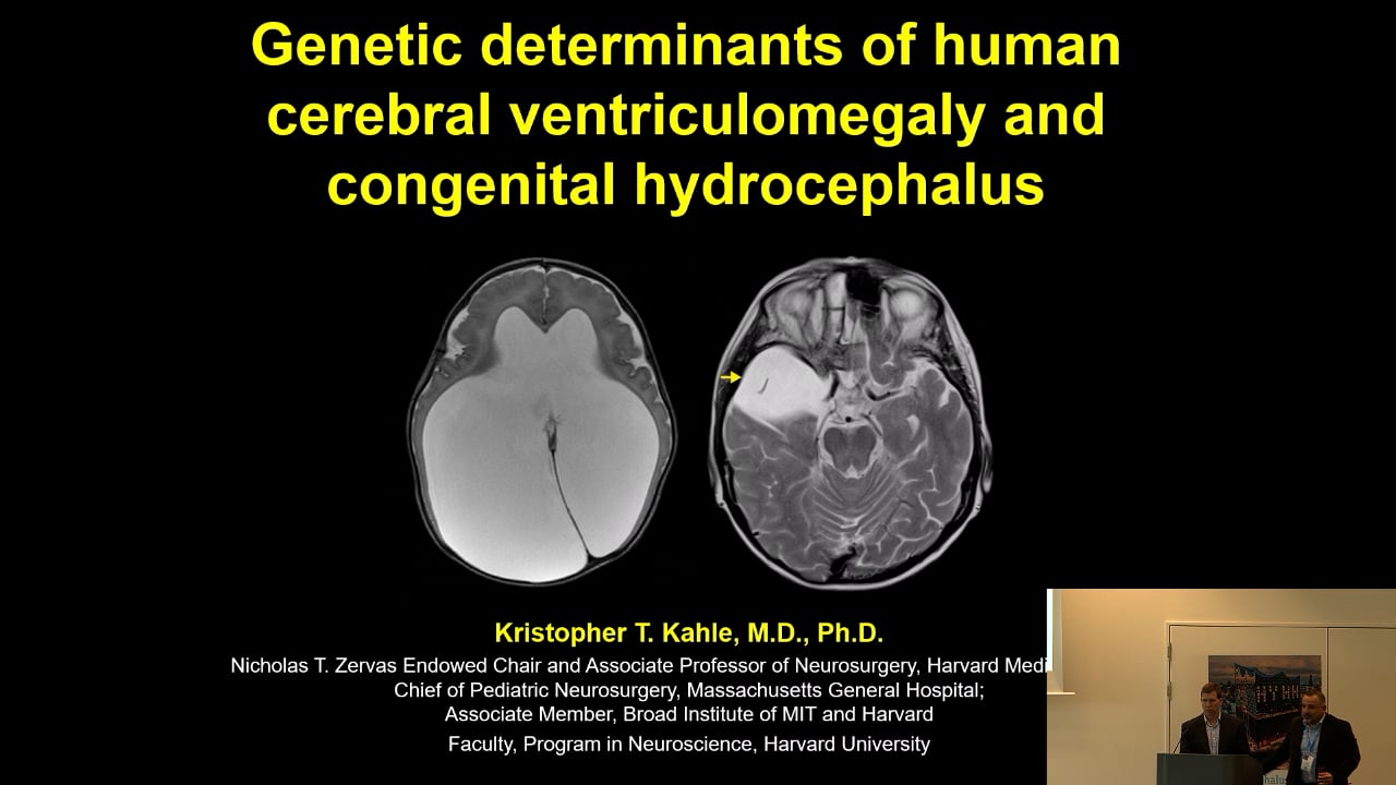 S6. Kristopher Kahle - Genetic determinants and molecular mechanisms of human cerebral ventricular size and congenital hydroceph
