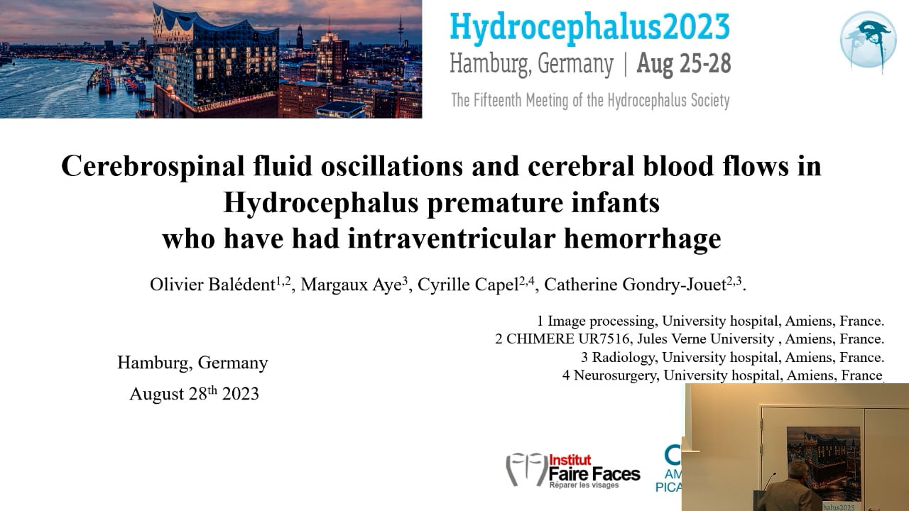 S6. Olivier Baledent - Cerebrospinal fluid oscillations and cerebral blood flows in hydrocephalus premature infants who have had