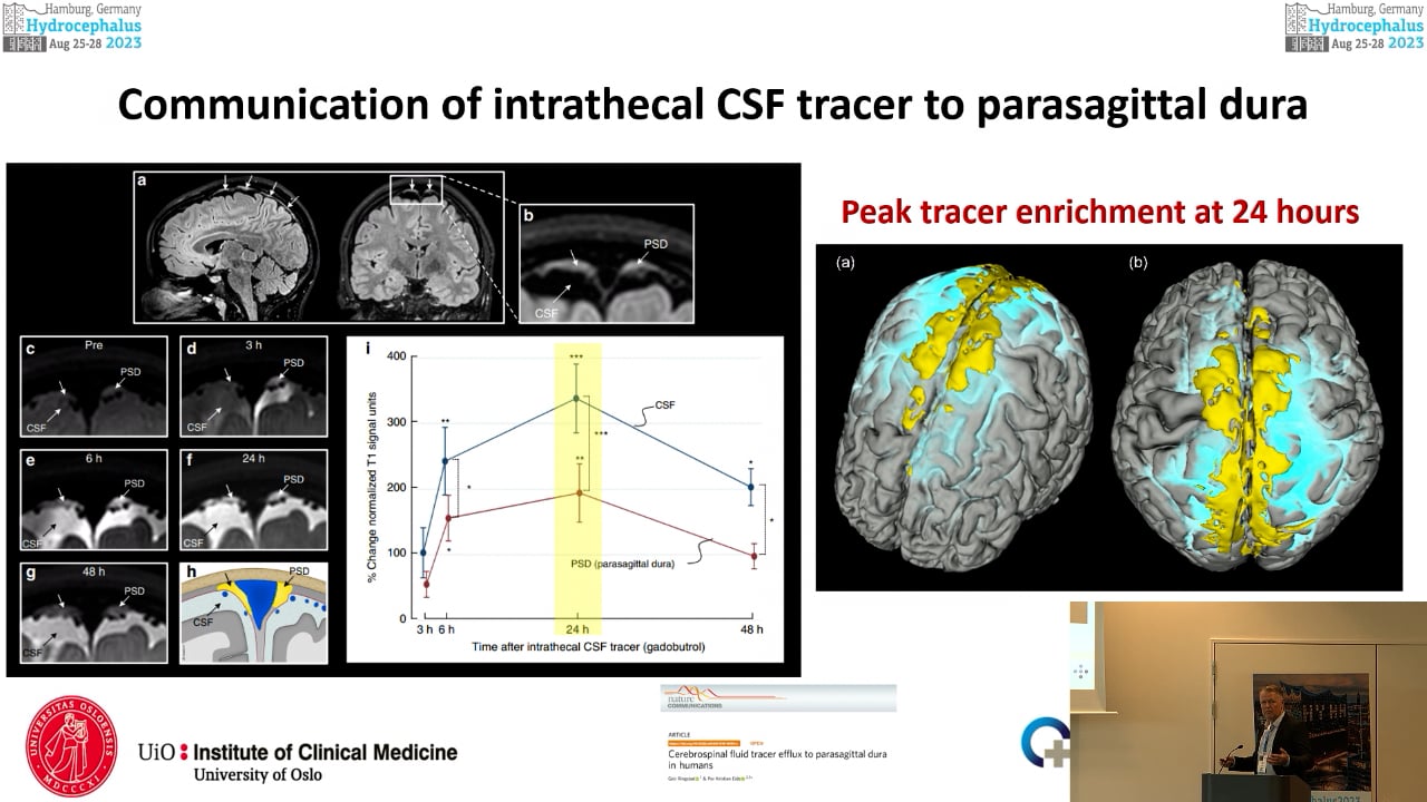 S11. Per Kristian Eide - Characteristics of human meningeal lymphatic vessels