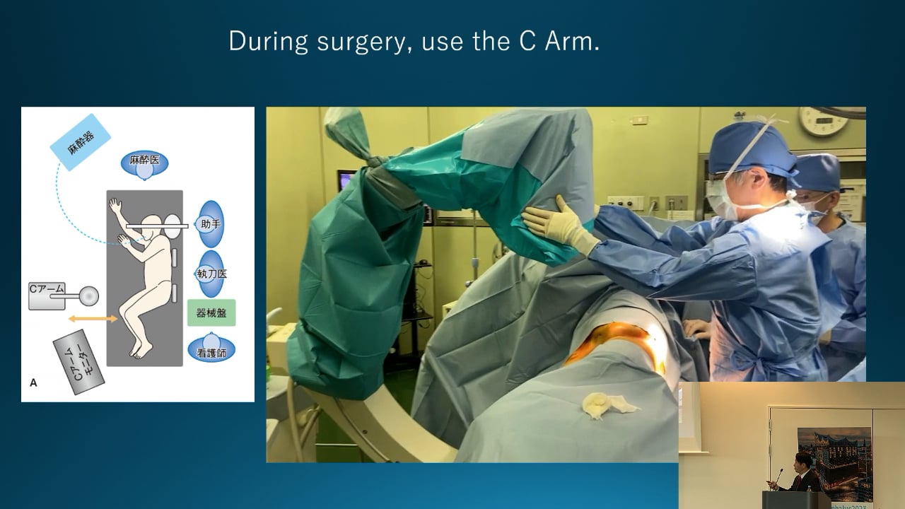 S16. Naoyuki Samejima - LP shunt in the patients with iNPH, Surgical technique