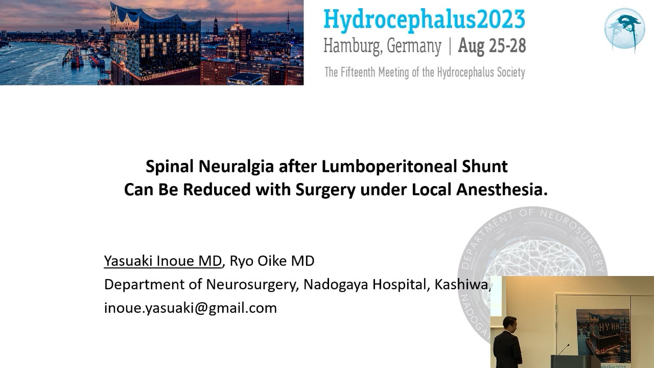 S16. Yasuaki Inoue - Neuralgia after Lumboperitoneal Shunt Can Be Reduced with Surgery under Local Anesthesia