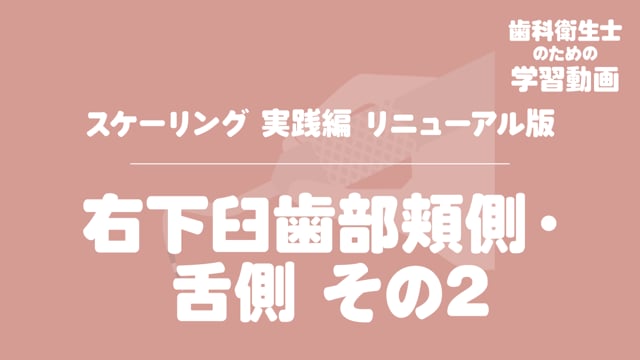 05.右下臼歯部頬側・舌側その2