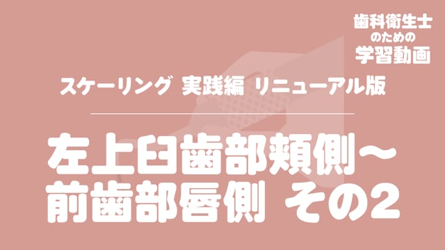 10.左上臼歯部頬側〜前歯部唇側その2